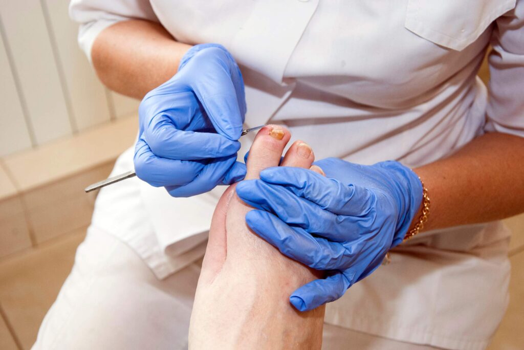 podiatrist for diabetes​