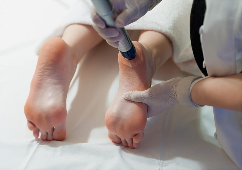 Extracorporeal Shockwave Therapy