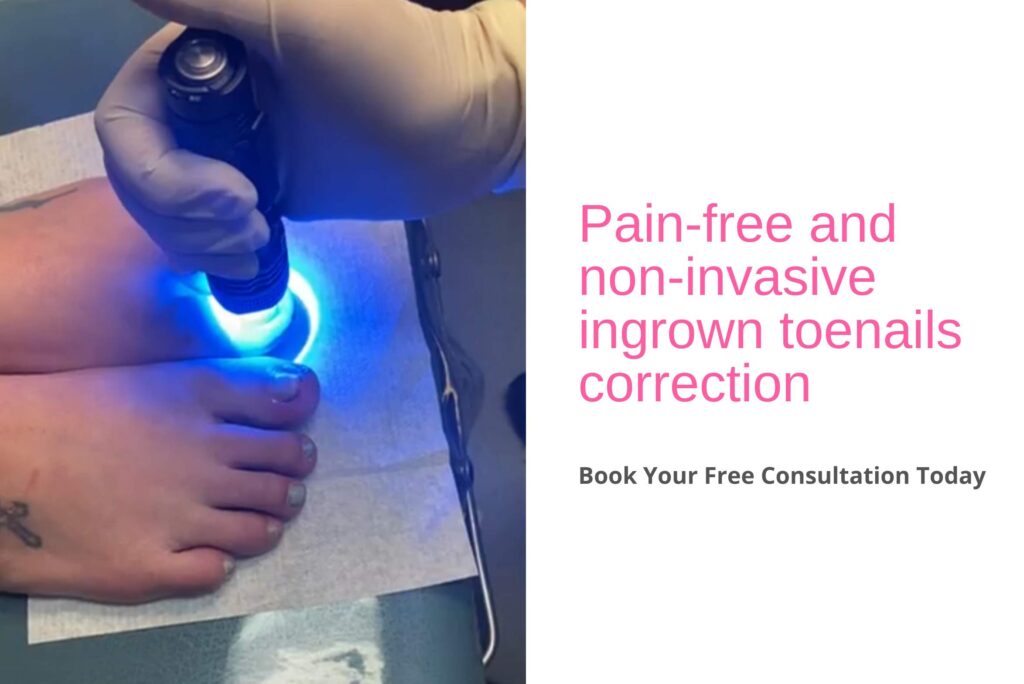 onyfix nail correction​